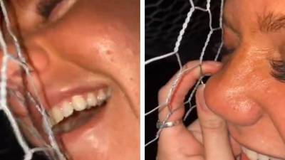 Son piercing de nez coincé dans un grillage à poule